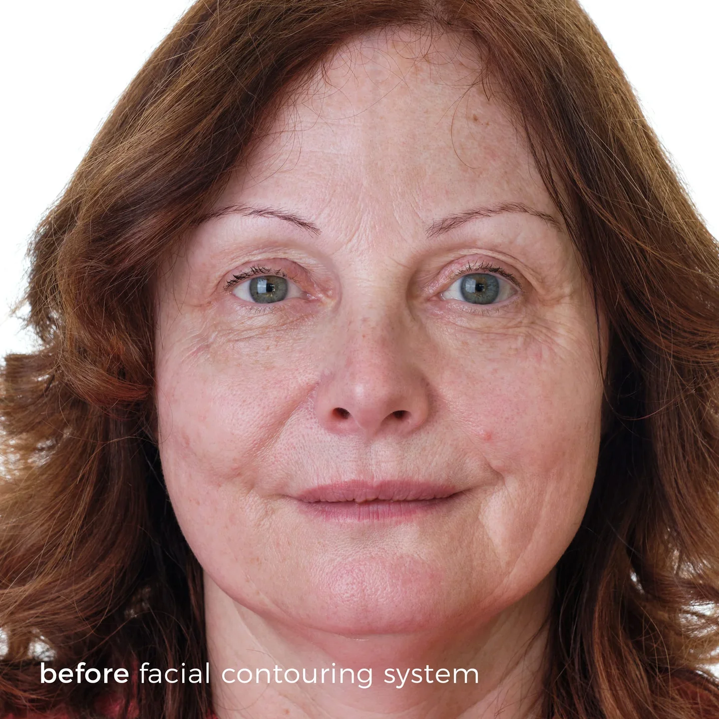 Skinbunny Facial Contouring System with Amino Acid Face Wash absolutely FREE - Image 4
