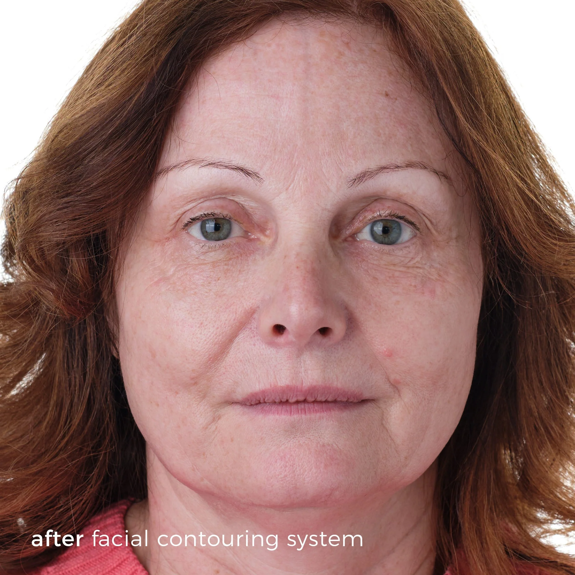 Skinbunny Facial Contouring System - Professional Pack 50 - Image 5