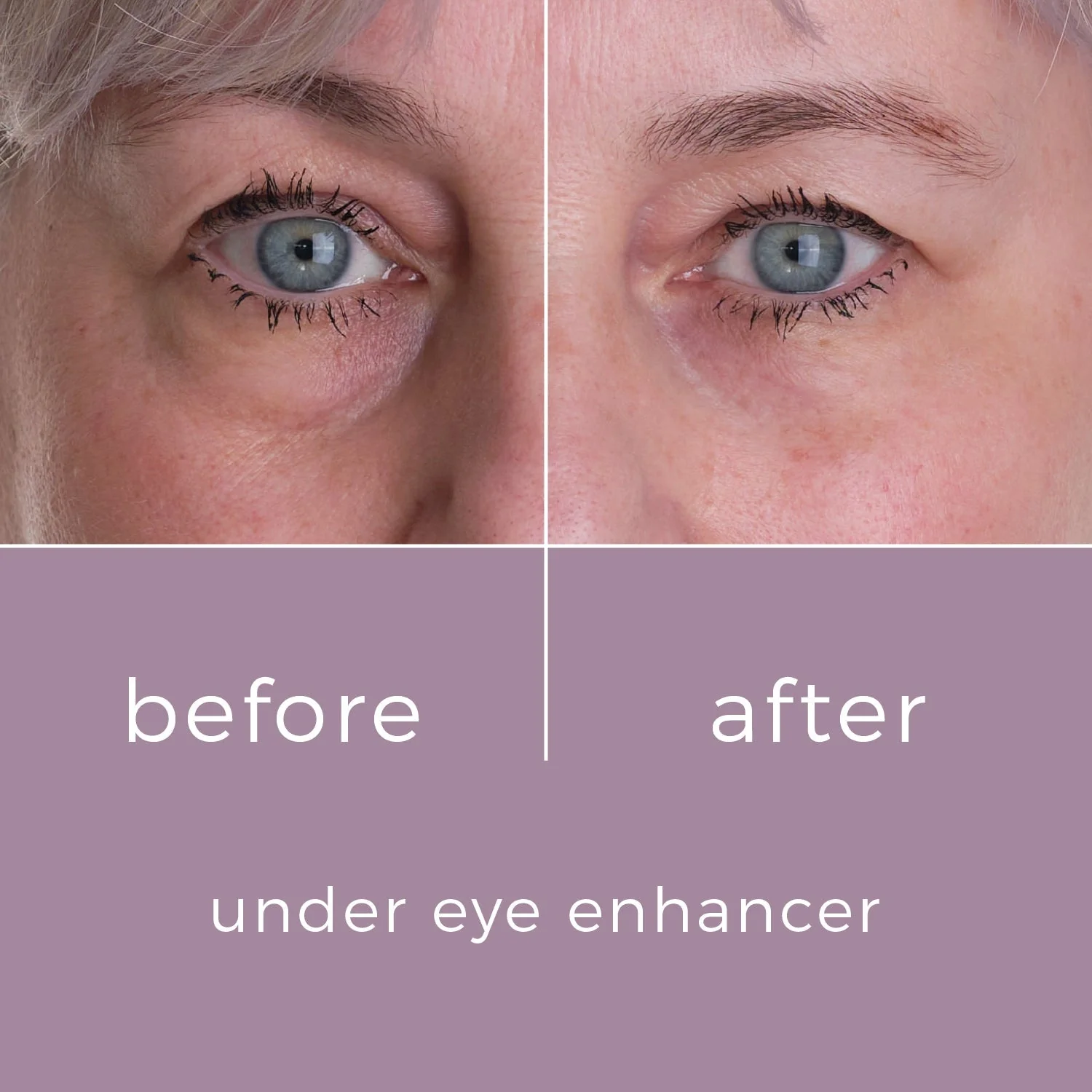 Skinbunny Under Eye Enhancer 100% extra absolutely FREE - Image 6