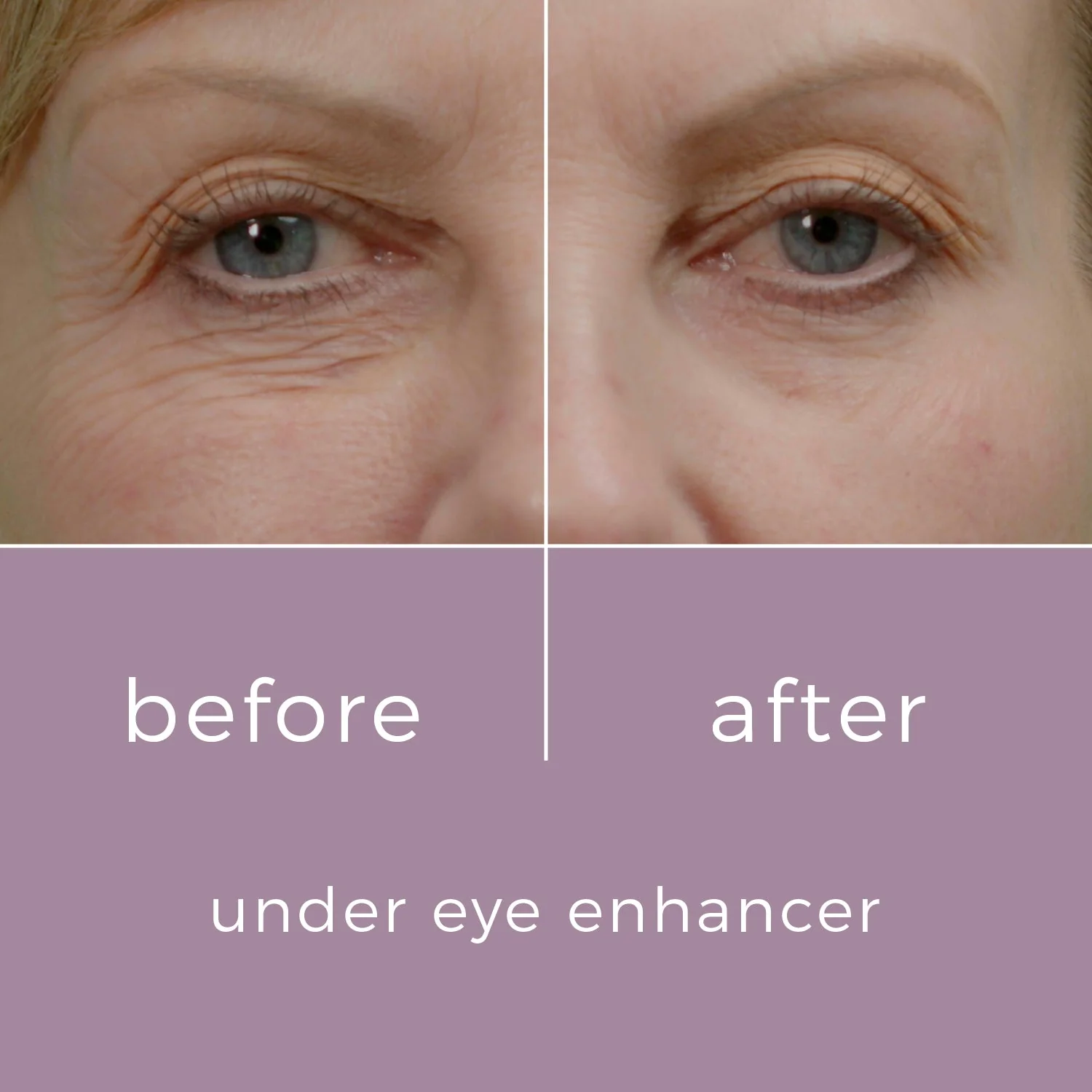Skinbunny Under Eye Enhancer... Flash Sale - Image 2