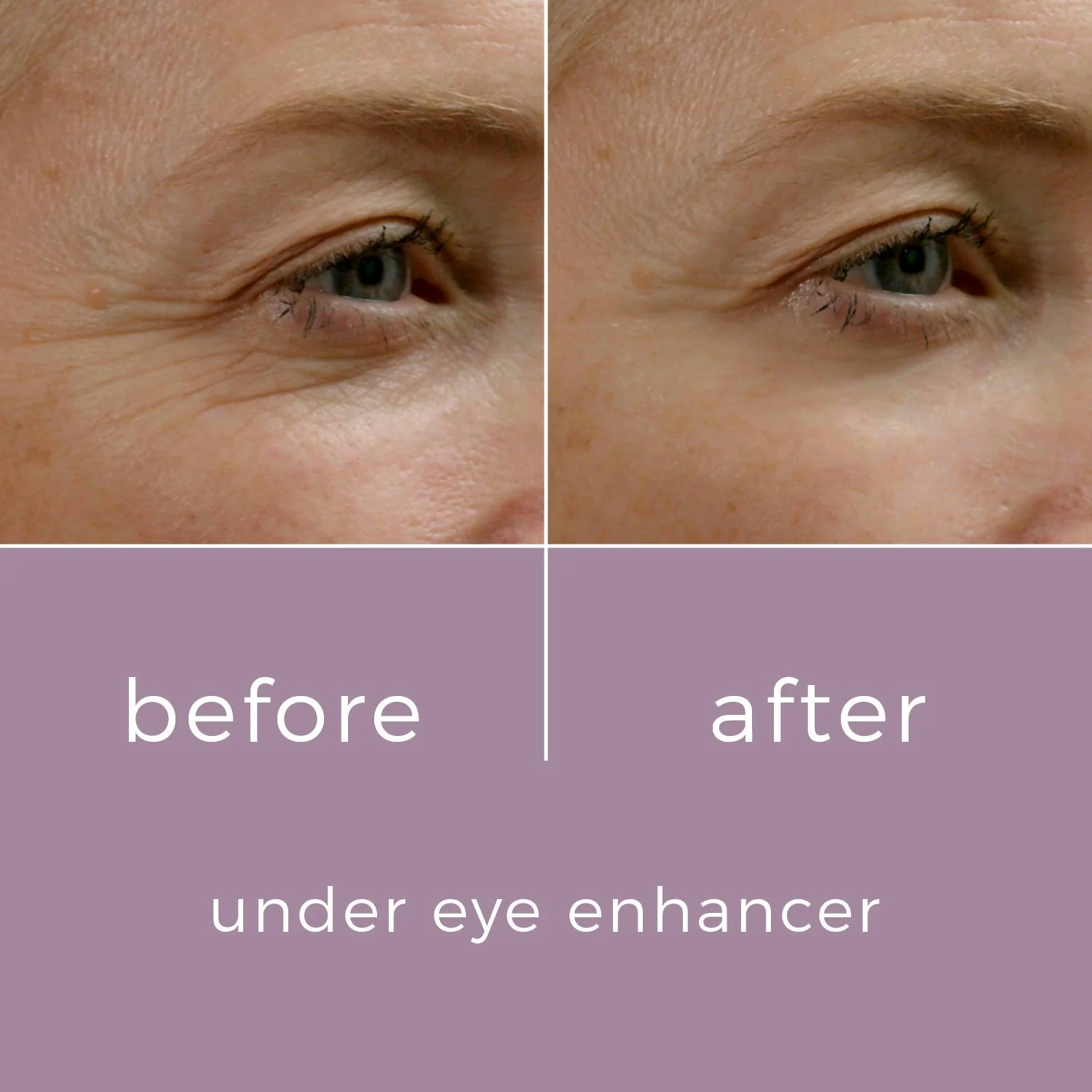 Skinbunny Under Eye Enhancer - Image 4