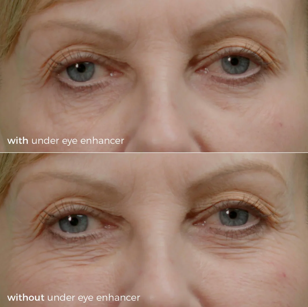 Skinbunny Under Eye Enhancer with Amino Acid Face Wash absolutely FREE - Image 6