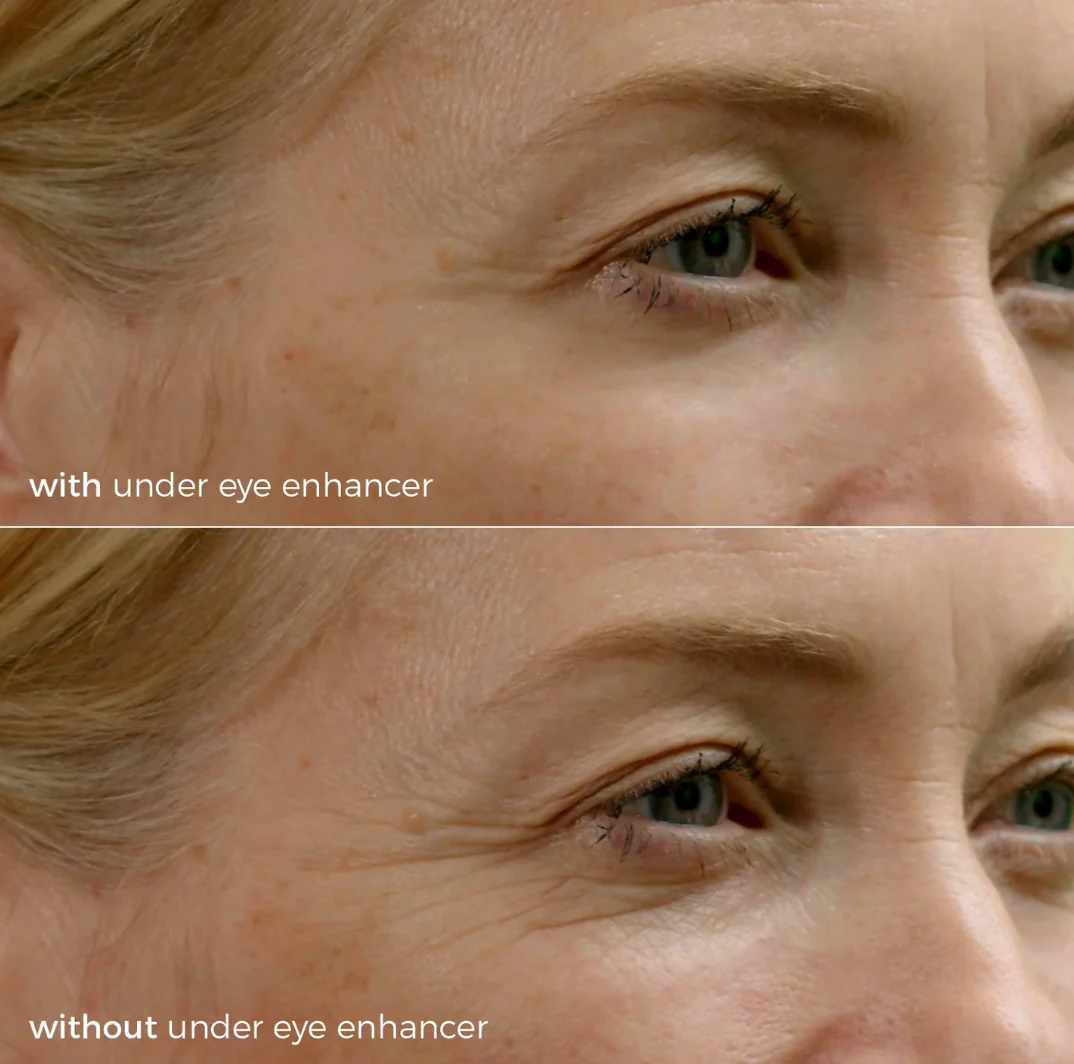 Skinbunny Under Eye Enhancer 200 & FREE Long Lasting Moisturiser - Image 6